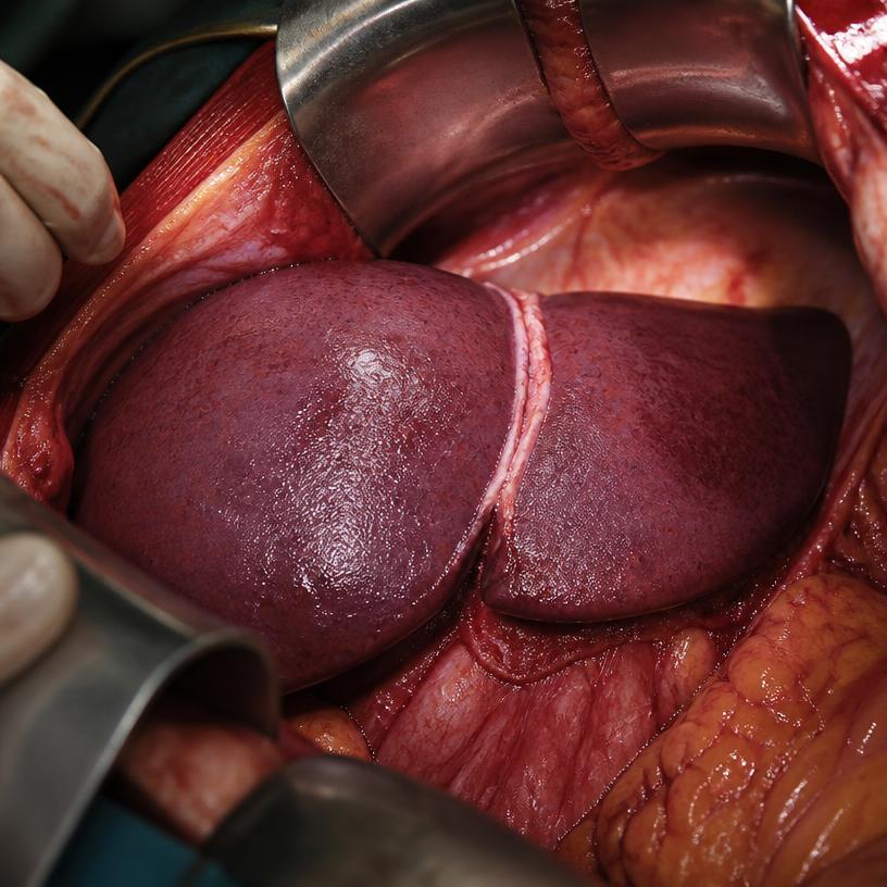 The Liver Unveiled: An Anatomical Odyssey